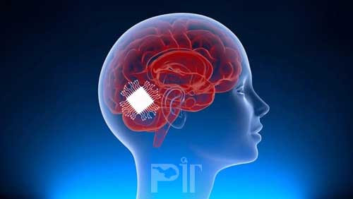 کنترل آیفون و آیپد با مغز به کمک فناوری جدید ایمپلنت
