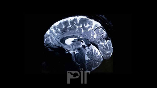 تصاویر مغز انسان با قوی ترین دستگاه MRI