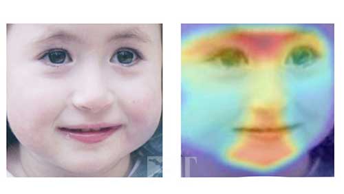 هوش مصنوعی بیماری‌ ها را از روی صورتتان می‌خواند